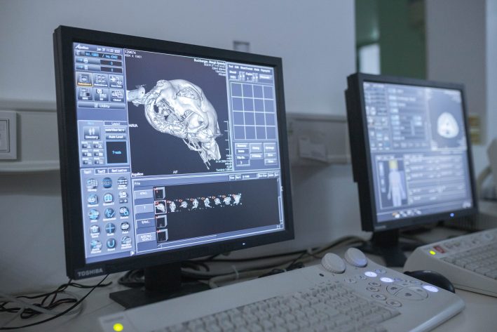 Computertomographie vom Schädel