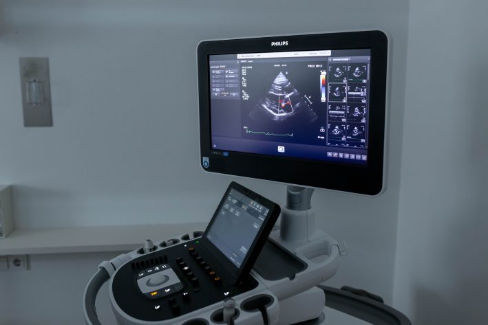 Herzultraschallaufnahme
