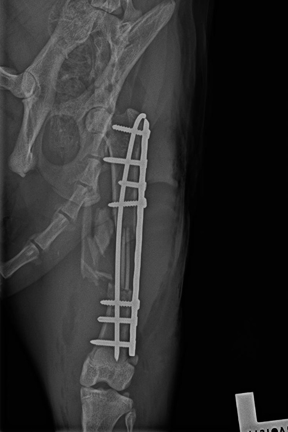 Versorgung Femurfraktur