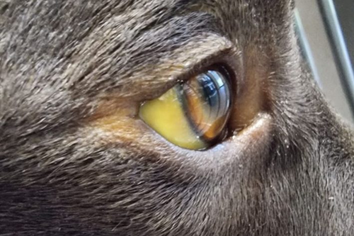 Ikterus: Gelbfärbung der Lederhaut des Auges