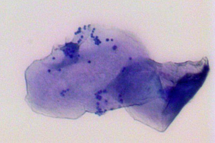zytologisches Abklatschpräparat: bakterielle Überwucherung
