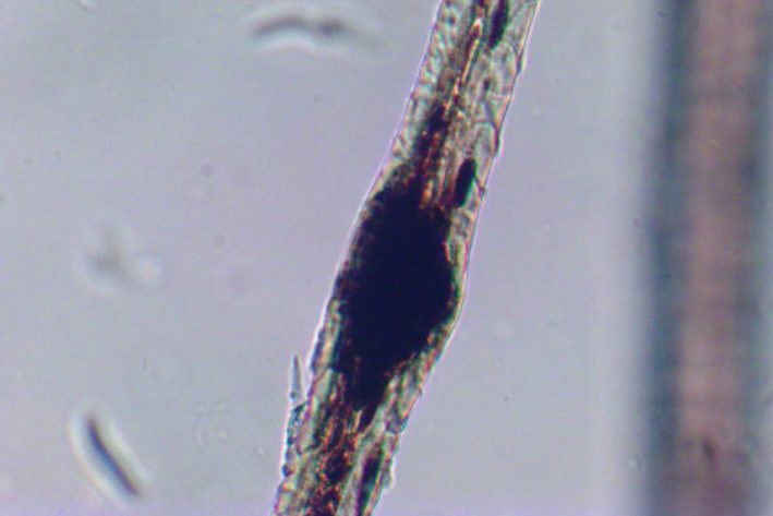 Farbmutantenalopezie