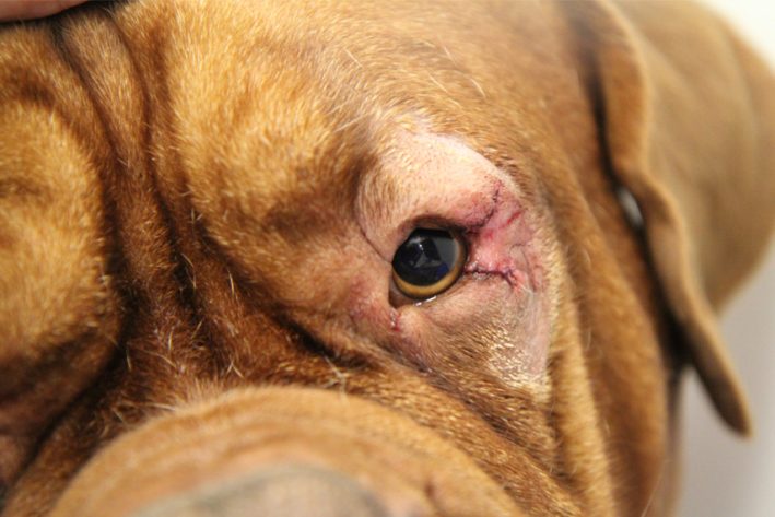 Korrigierte Augenlider wenige Wochen nach der Operation