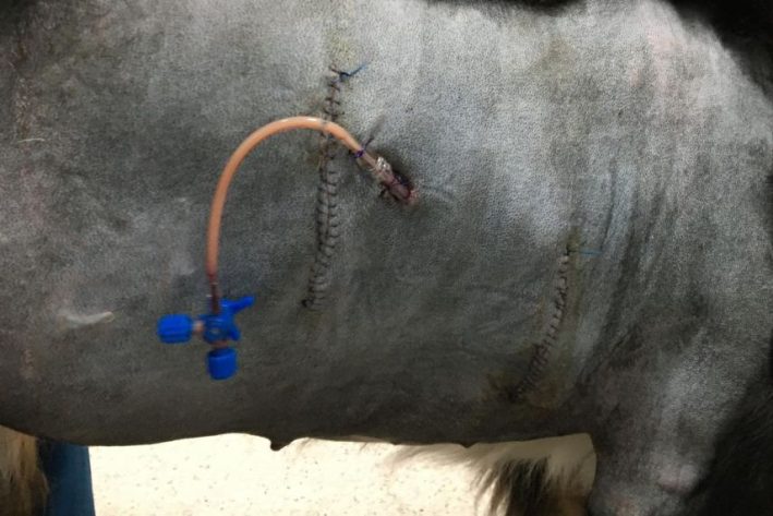 Liquidothorax Drainage