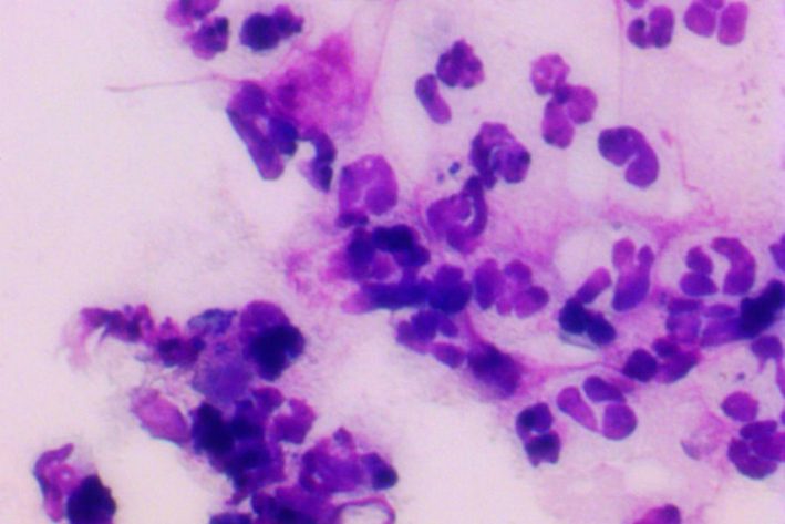 Oberflaechliche Bakterielle Hautinfektion 855x570px