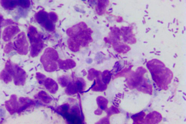 OtitisRods 855x570px