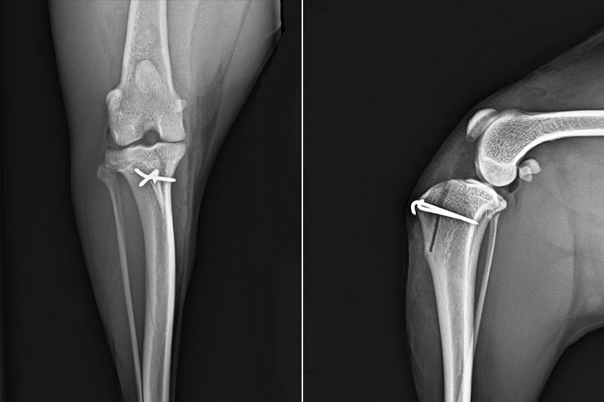 Patellaluxation post operativ