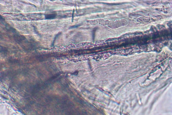 Pilzhyphen unter dem Mikroskop