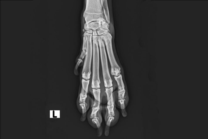 Röntgenbild Primäre Zehengelenksarthrose