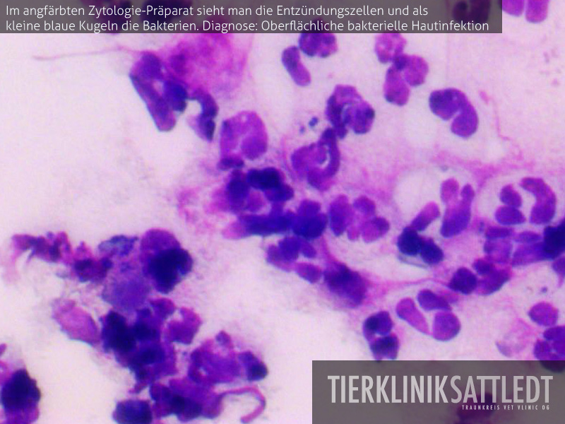 Im angefärbten Zytologie-Präparat sieht man die Entzündungszellen und als kleine blaue Kugeln die Bakterien. Diagnose: Oberflächliche bakterielle Hautinfektion