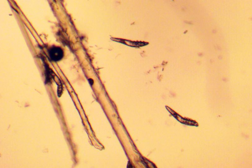 Demodex-Milben_Mikroskop