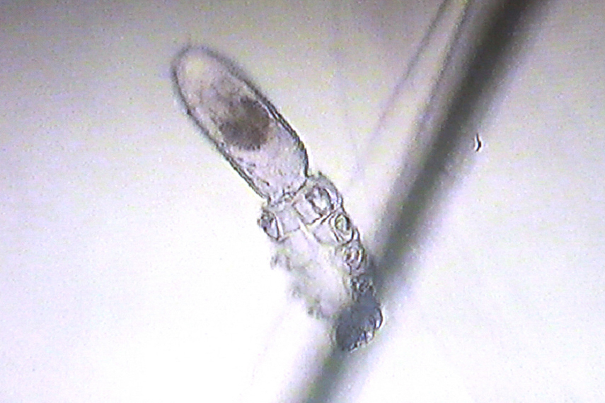 Demodex-Milbe Katze