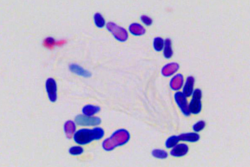 Otitis Malassa